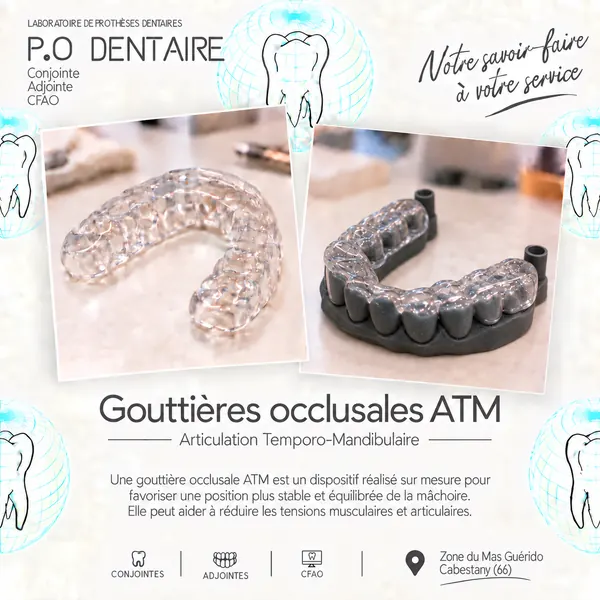 Gouttières occlusales ATM
