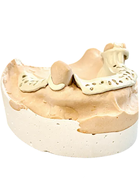 Châssis beige sur modèle