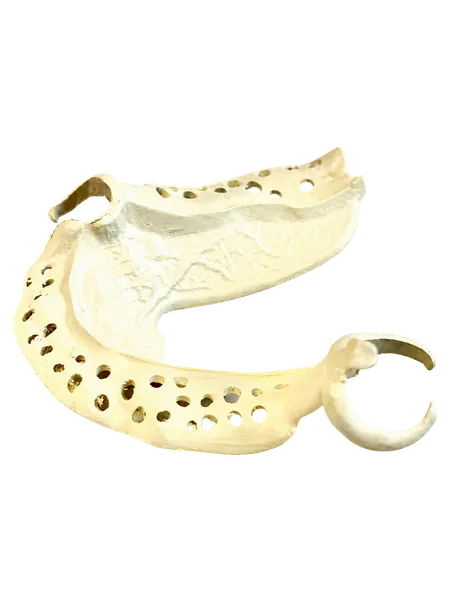 Châssis beige
