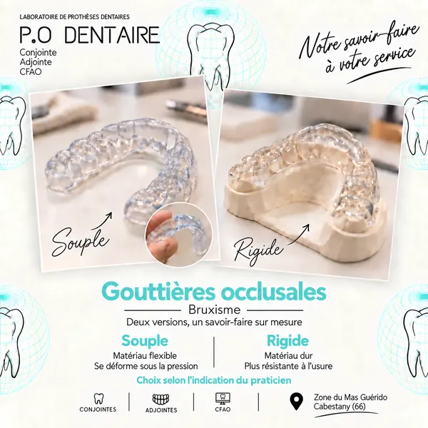 Gouttières occlusales : souple et rigide