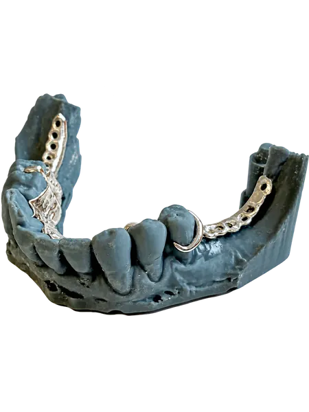 Détail du châssis métallique